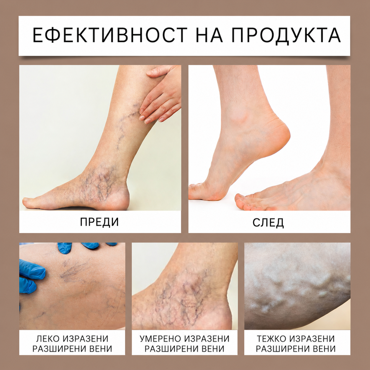 Гел  с Конски Кестен