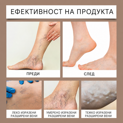 Гел  с Конски Кестен