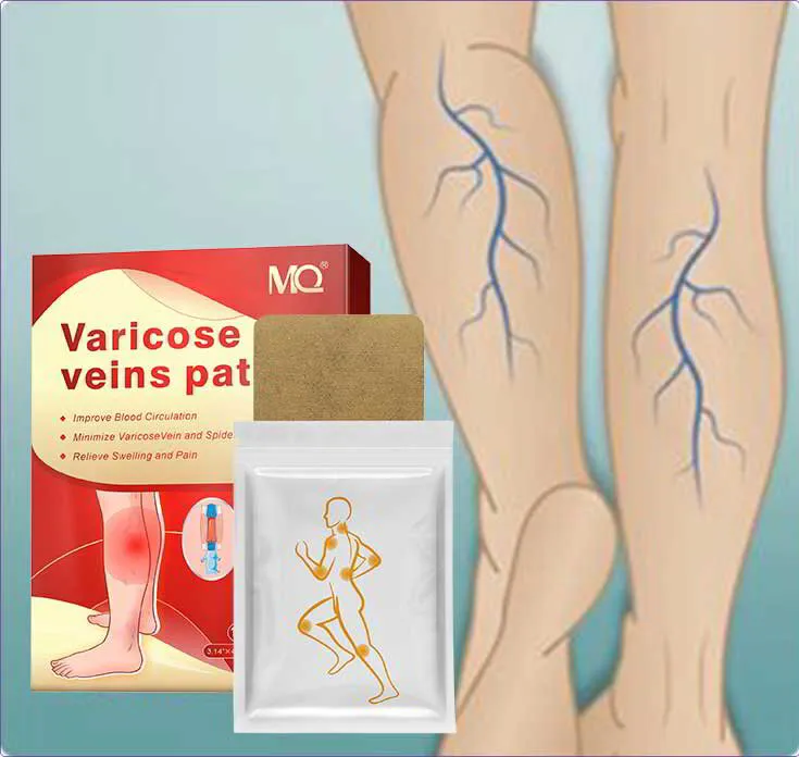 Билкови пластири за Разширени Вени (12бр.)